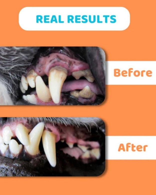 Effective teeth-cleaning wipes